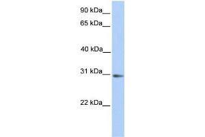 Human Placenta; WB Suggested Anti-ABHD13 Antibody Titration: 0. (ABHD13 anticorps  (N-Term))