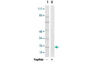 Western blot analysis of extracts from HT-29 cells, using GJB7 polyclonal antibody . (GJB7 anticorps)