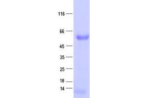 Validation with Western Blot (SOCS4 Protein (His tag))