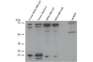 Western Blot analysis of BSP expression in different cell lines. (BSP anticorps  (AA 201-211))