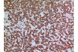 Immunohistochemical analysis of paraffin-embedded human-liver, antibody was diluted at 1:100. (APAF1 anticorps  (Internal Region))