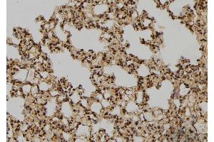 ABIN6276428 at 1/100 staining Rat lung tissue by IHC-P. (RAN anticorps  (C-Term))