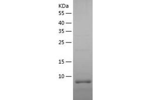 Western Blotting (WB) image for Metallothionein 4 (MT4) (AA 1-62) protein (His tag) (ABIN7123927)