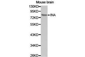 Western Blotting (WB) image for anti-Internexin Neuronal Intermediate Filament Protein, alpha (INA) antibody (ABIN1873228)