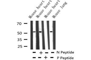 Western blot analysis of Phospho-MITF (Ser180/73) expression in various lysates