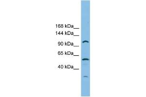 WB Suggested Anti-CHTF18 Antibody Titration: 0. (CTF18 anticorps  (Middle Region))