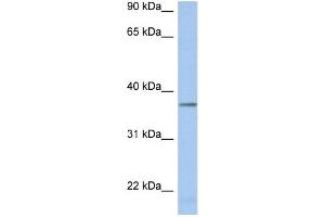 WB Suggested Anti-LDHAL6B Antibody Titration: 0. (LDHAL6B anticorps  (Middle Region))