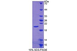 SDS-PAGE analysis of Rat CALY Protein. (CALY Protéine)