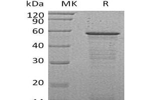 Western Blotting (WB) image for Host Cell Factor C2 (HCFC2) protein (His tag) (ABIN7320755)