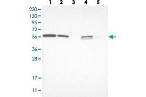 Western blot analysis of Lane 1: RT-4, Lane 2: U-251 MG, Lane 3: Human Plasma, Lane 4: Liver, Lane 5: Tonsil with LETM2 polyclonal antibody  at 1:250-1:500 dilution. (LETM2 anticorps)