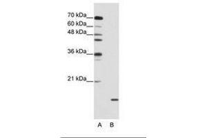 Image no. 2 for anti-Small Nuclear Ribonucleoprotein Polypeptide A (SNRPA) (AA 176-225) antibody (ABIN203017) (SNRPA1 anticorps  (AA 176-225))