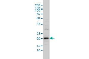 C20orf102 monoclonal antibody (M01), clone 3B9 Western Blot analysis of C20orf102 expression in IMR-32 . (VSTM2L anticorps  (AA 25-204))