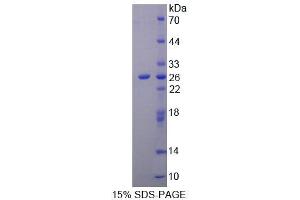 SDS-PAGE analysis of Rat NIN Protein. (Ninein Protéine)