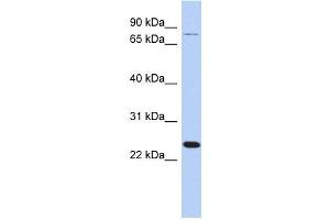 RPS7 antibody used at 1 ug/ml to detect target protein. (RPS7 anticorps  (Middle Region))