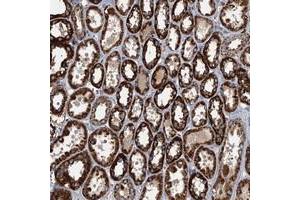 Immunohistochemical staining of human kidney with SPDYC polyclonal antibody  shows strong cytoplasmic positivity in tubular cells at 1:50-1:200 dilution. (SPDYC anticorps)