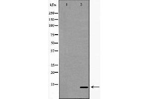 Western blot analysis of Ramos  lysate using TCL1A antibody. (TCL1A anticorps  (Internal Region))