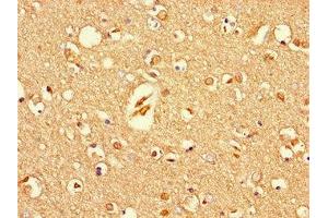 Immunohistochemistry of paraffin-embedded human brain tissue using ABIN7166261 at dilution of 1:100