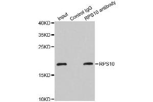 Immunoprecipitation analysis of 200 μg extracts of MCF-7 cells using 1 μg RPS10 antibody (ABIN5973486). (RPS10 anticorps)