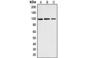 Western blot analysis of Cyclin M2 expression in K562 (A), HT1080 (B), Hela (C) whole cell lysates. (Cyclin M2 anticorps  (Center))