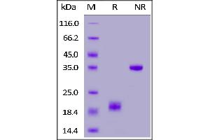 Mouse CD3 epsilon&CD3 gamma Heterodimer Protein, His Tag&Flag Tag on  under reducing (R) and ing (NR) conditions.