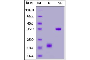 Mouse CD3 epsilon&CD3 gamma Heterodimer Protein, His Tag&Flag Tag on  under reducing (R) and ing (NR) conditions. (CD3E & CD3G (AA 23-108) (Active) protein (His tag,DYKDDDDK Tag))