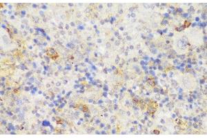 Immunohistochemistry of paraffin-embedded Mouse spleen using GCC2 Polyclonal Antibody at dilution of 1:150 (40x lens). (GCC2 anticorps)