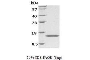 Figure annotation denotes ug of protein loaded and % gel used. (GM-CSF Protéine)