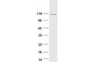 Validation with Western Blot