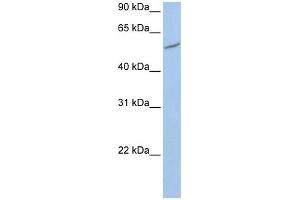 WB Suggested Anti-RIOK3  Antibody Titration: 0. (RIOK3 anticorps  (C-Term))