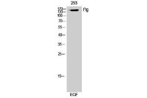 Western Blotting (WB) image for anti-Filaggrin (FLG) (Ser378) antibody (ABIN3184631) (Filaggrin anticorps  (Ser378))