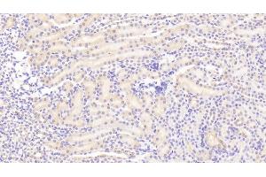 Detection of TFR in Mouse Kidney Tissue using Polyclonal Antibody to Transferrin Receptor (TFR)