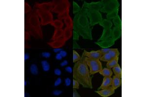 ABIN6257876 and ABIN6275617 staining Hela cells(30 min of UV treatment) by IF/ICC.
