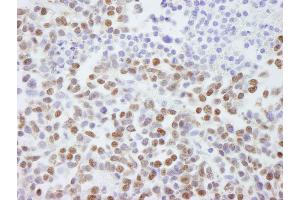 Immunohistochemistry (IHC) image for anti-Scaffold Attachment Factor B2 (SAFB2) (AA 175-225) antibody (ABIN7448785) (SAFB2 anticorps  (AA 175-225))