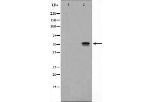 Western blot analysis on HeLa cell lysate using ITPK1 Antibody,The lane on the left is treated with the antigen-specific peptide. (ITPK1 anticorps  (Internal Region))