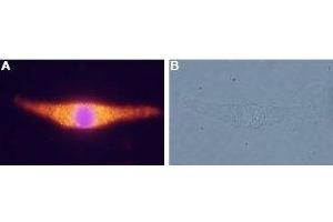 Expression of NTR2 in rat C6 glioma cells - Immunocytochemical staining of rat C6 glioma cells.