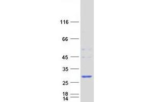 Validation with Western Blot (HDHD1 Protein (Transcript Variant 2) (Myc-DYKDDDDK Tag))