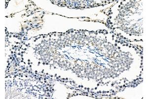 ABIN6258041 and ABIN6273478 at 1/100 staining Rat testis tissue by IHC-P. (CYLC2 anticorps  (C-Term))