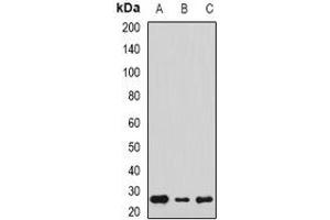 Western blot analysis of Sigma1 Receptor expression in Hela (A), SW620 (B), HepG2 (C) whole cell lysates.