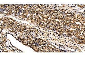 Detection of IRAK4 in Mouse Kidney Tissue using Polyclonal Antibody to Interleukin 1 Receptor Associated Kinase 4 (IRAK4)