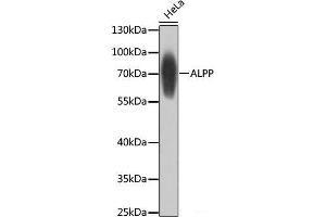 Western blot analysis of extracts of HeLa cells using ALPP Polyclonal Antibody at dilution of 1:1000. (PLAP anticorps)