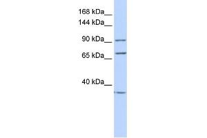 WB Suggested Anti-EEF2 Antibody Titration: 0. (EEF2 anticorps  (N-Term))