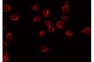 ABIN6276414 staining HuvEc by IF/ICC.