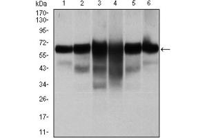 Western blot analysis using CK5 antibody against human CK5 (AA: 158-272) recombinant protein. (Cytokeratin 5 anticorps)