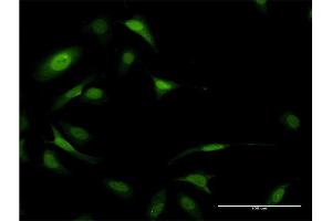 Immunofluorescence of monoclonal antibody to EIF5A on HeLa cell.