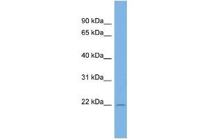 WB Suggested Anti-C13orf28 Antibody Titration: 0. (SPACA7 anticorps  (Middle Region))