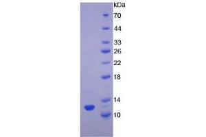 SDS-PAGE analysis of Rat TGFa Protein.