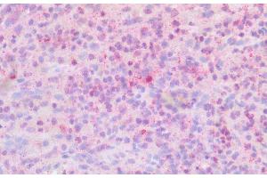 Detection of PLCb2 in Human Spleen Tissue using Polyclonal Antibody to Phospholipase C Beta 2 (PLCb2)