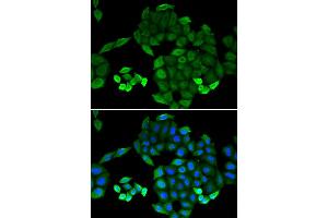 Immunofluorescence (IF) image for anti-6-Pyruvoyltetrahydropterin Synthase (PTS) antibody (ABIN1980322) (PTS anticorps)