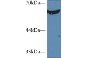 Detection of PKM2 in Human K562 cell lysate using Polyclonal Antibody to Pyruvate kinase isozymes M2 (PKM2)