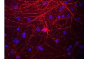 Immunostaining of cultured rat neurons and glia showing labeling of NF-M in red. (NEFM anticorps  (C-Term))